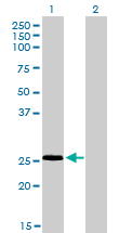 RNF141 Antibody - Western blot of RNF141 expression in transfected 293T cell line by RNF141 monoclonal antibody (M01), clone 6D9.