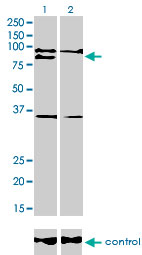 RNF141 Antibody - Western blot of RNF141 over-expressed 293 cell line, cotransfected with RNF141 Validated Chimera RNAi (Lane 2) or non-transfected control (Lane 1). Blot probed with RNF141 monoclonal antibody, clone 6D9. GAPDH ( 36.1 kD ) used as specific.