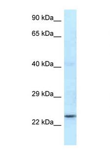 RNF141 Antibody - RNF141 antibody Western blot of Mouse Kidney lysate. Antibody concentration 1 ug/ml.  This image was taken for the unconjugated form of this product. Other forms have not been tested.