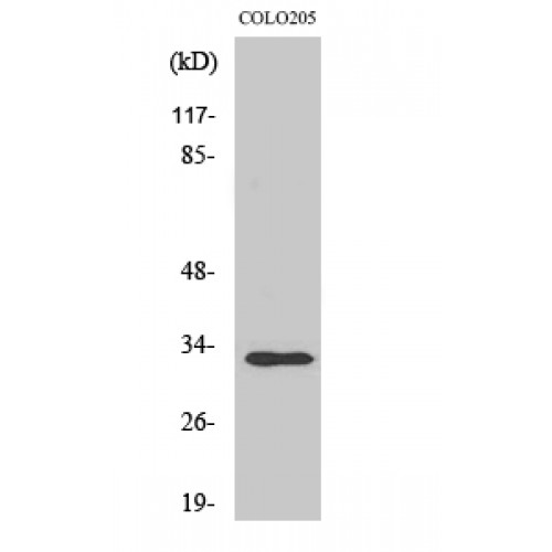 RNF144A / RNF144 Antibody - Western blot of UBCE7IP4 antibody