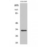 RNF144A / RNF144 Antibody - Western blot of UBCE7IP4 antibody