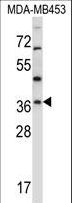 RNF144A / RNF144 Antibody - RNF144A Antibody western blot of MDA-MB453 cell line lysates (35 ug/lane). The RNF144A antibody detected the RNF144A protein (arrow).