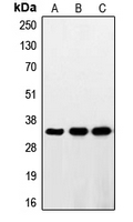 RNF144A / RNF144 Antibody - Western blot analysis of RNF144A expression in HeLa (A); HepG2 (B); Jurkat (C) whole cell lysates.