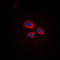 RNF144A / RNF144 Antibody - Immunofluorescent analysis of RNF144A staining in HepG2 cells. Formalin-fixed cells were permeabilized with 0.1% Triton X-100 in TBS for 5-10 minutes and blocked with 3% BSA-PBS for 30 minutes at room temperature. Cells were probed with the primary antibody in 3% BSA-PBS and incubated overnight at 4 C in a humidified chamber. Cells were washed with PBST and incubated with a DyLight 594-conjugated secondary antibody (red) in PBS at room temperature in the dark. DAPI was used to stain the cell nuclei (blue).