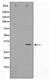 RNF144A / RNF144 Antibody - Western blot of COLO205 cell lysate using RNF144A Antibody