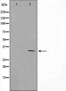 RNF144A / RNF144 Antibody - Western blot analysis on COLO205 cell lysates using RNF144A antibody. The lane on the left is treated with the antigen-specific peptide.
