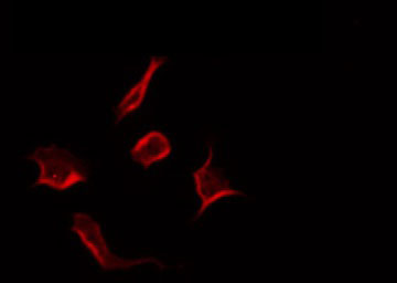 RNF144A / RNF144 Antibody - Staining COLO205 cells by IF/ICC. The samples were fixed with PFA and permeabilized in 0.1% Triton X-100, then blocked in 10% serum for 45 min at 25°C. The primary antibody was diluted at 1:200 and incubated with the sample for 1 hour at 37°C. An Alexa Fluor 594 conjugated goat anti-rabbit IgG (H+L) Ab, diluted at 1/600, was used as the secondary antibody.