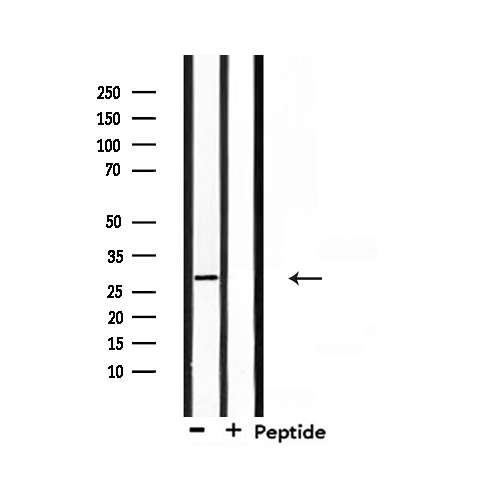 RNF144A / RNF144 Antibody - Western blot analysis of extracts of mouse lung using RNF144A antibody.