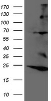 RNF144B Antibody - HEK293T cells were transfected with the pCMV6-ENTRY control (Left lane) or pCMV6-ENTRY RNF144B (Right lane) cDNA for 48 hrs and lysed. Equivalent amounts of cell lysates (5 ug per lane) were separated by SDS-PAGE and immunoblotted with anti-RNF144B.