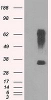 RNF144B Antibody - HEK293T cells were transfected with the pCMV6-ENTRY control (Left lane) or pCMV6-ENTRY RNF144B (Right lane) cDNA for 48 hrs and lysed. Equivalent amounts of cell lysates (5 ug per lane) were separated by SDS-PAGE and immunoblotted with anti-RNF144B.