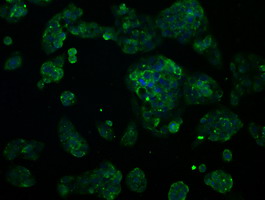 RNF144B Antibody - Immunofluorescent staining of HeLa cells using anti-RNF144B mouse monoclonal antibody.