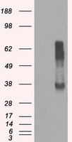 RNF144B Antibody - HEK293T cells were transfected with the pCMV6-ENTRY control (Left lane) or pCMV6-ENTRY RNF144B (Right lane) cDNA for 48 hrs and lysed. Equivalent amounts of cell lysates (5 ug per lane) were separated by SDS-PAGE and immunoblotted with anti-RNF144B.