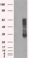 RNF144B Antibody - HEK293T cells were transfected with the pCMV6-ENTRY control (Left lane) or pCMV6-ENTRY RNF144B (Right lane) cDNA for 48 hrs and lysed. Equivalent amounts of cell lysates (5 ug per lane) were separated by SDS-PAGE and immunoblotted with anti-RNF144B.