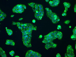 RNF144B Antibody - Immunofluorescent staining of HeLa cells using anti-RNF144B mouse monoclonal antibody.