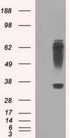 RNF144B Antibody - HEK293T cells were transfected with the pCMV6-ENTRY control (Left lane) or pCMV6-ENTRY RNF144B (Right lane) cDNA for 48 hrs and lysed. Equivalent amounts of cell lysates (5 ug per lane) were separated by SDS-PAGE and immunoblotted with anti-RNF144B.