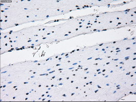 RNF144B Antibody - IHC of paraffin-embedded colon tissue using anti-RNF144B mouse monoclonal antibody. (Dilution 1:50).