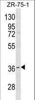 RNF144B Antibody - RNF144B Antibody western blot of ZR-75-1 cell line lysates (35 ug/lane). The RNF144B antibody detected the RNF144B protein (arrow).