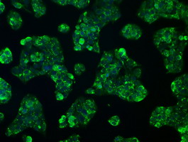 RNF144B Antibody - Immunofluorescent staining of HeLa cells using anti-RNF144B mouse monoclonal antibody.
