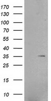 RNF144B Antibody - HEK293T cells were transfected with the pCMV6-ENTRY control (Left lane) or pCMV6-ENTRY RNF144B (Right lane) cDNA for 48 hrs and lysed. Equivalent amounts of cell lysates (5 ug per lane) were separated by SDS-PAGE and immunoblotted with anti-RNF144B.
