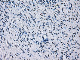 RNF144B Antibody - IHC of paraffin-embedded Ovary tissue using anti-RNF144B mouse monoclonal antibody. (Dilution 1:50).