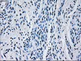 RNF144B Antibody - IHC of paraffin-embedded endometrium tissue using anti-RNF144B mouse monoclonal antibody. (Dilution 1:50).