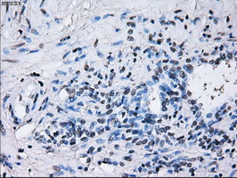 RNF144B Antibody - IHC of paraffin-embedded prostate tissue using anti-RNF144B mouse monoclonal antibody. (Dilution 1:50).