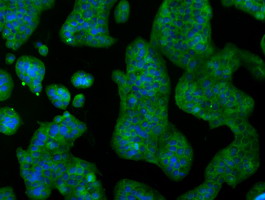 RNF144B Antibody - Immunofluorescent staining of HeLa cells using anti-RNF144B mouse monoclonal antibody.