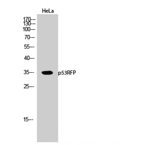 RNF144B Antibody - Western blot of RNF144b antibody