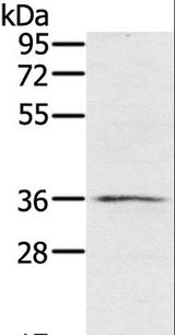RNF144B Antibody - Western blot analysis of TM4 cell, using RNF144B Polyclonal Antibody at dilution of 1:400.