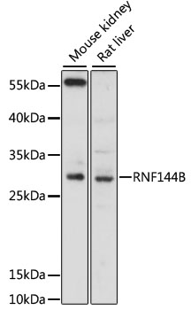 RNF144B Antibody - Western blot analysis of extracts of various cell lines, using RNF144B antibody at 1:3000 dilution. The secondary antibody used was an HRP Goat Anti-Rabbit IgG (H+L) at 1:10000 dilution. Lysates were loaded 25ug per lane and 3% nonfat dry milk in TBST was used for blocking. An ECL Kit was used for detection and the exposure time was 90s.