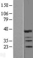 RNF144B Protein - Western validation with an anti-DDK antibody * L: Control HEK293 lysate R: Over-expression lysate