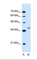 RNF146 Antibody - Lane A: Marker. Lane B: HepG2 cell lysate. Antibody concentration: 1.25 ug/ml. Gel concentration: 12%.  This image was taken for the unconjugated form of this product. Other forms have not been tested.