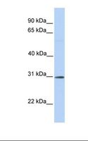 RNF148 Antibody - Fetal brain lysate. Antibody concentration: 1.0 ug/ml. Gel concentration: 12%.  This image was taken for the unconjugated form of this product. Other forms have not been tested.