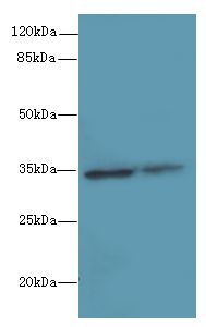 RNF148 Antibody - Western blot. All lanes: RNF148 antibody at 6 ug/ml. Lane 1: HeLa whole cell lysate. Lane 2: HepG-2 whole cell lysate. Secondary Goat polyclonal to Rabbit IgG at 1:10000 dilution. Predicted band size: 34 kDa. Observed band size: 34 kDa.