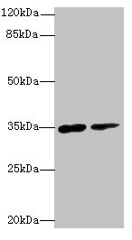 RNF148 Antibody - Western blot All lanes: RNF148 antibody at 6µg/ml Lane 1: Hela whole cell lysate Lane 2: HepG2 whole cell lysate Secondary Goat polyclonal to rabbit IgG at 1/10000 dilution Predicted band size: 34 kDa Observed band size: 34 kDa