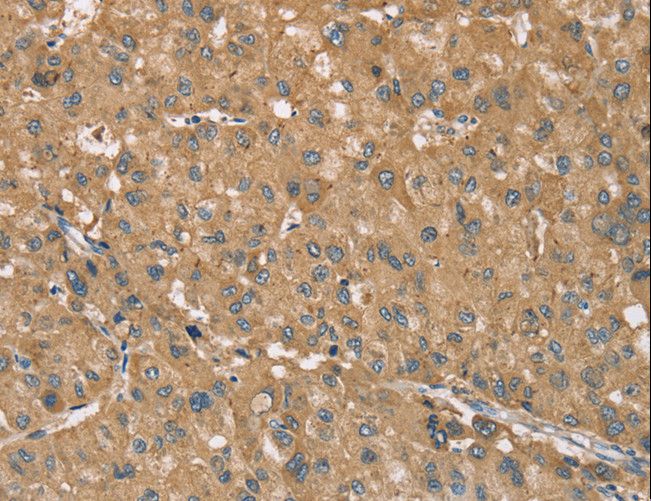 RNF148 Antibody - Immunohistochemistry of paraffin-embedded Human brain using RNF148 Polyclonal Antibody at dilution of 1:40.