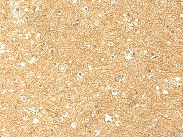 RNF148 Antibody - Immunohistochemistry of paraffin-embedded Human brain tissue  using RNF148 Polyclonal Antibody at dilution of 1:50(×200)