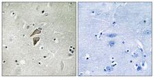 RNF149 Antibody - Immunohistochemistry analysis of paraffin-embedded human brain tissue, using RNF149 Antibody. The picture on the right is blocked with the synthesized peptide.