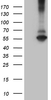 RNF149 Antibody - HEK293T cells were transfected with the pCMV6-ENTRY control. (Left lane) or pCMV6-ENTRY RNF149. (Right lane) cDNA for 48 hrs and lysed. Equivalent amounts of cell lysates. (5 ug per lane) were separated by SDS-PAGE and immunoblotted with anti-RNF149. (1:2000)