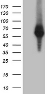 RNF149 Antibody - HEK293T cells were transfected with the pCMV6-ENTRY control. (Left lane) or pCMV6-ENTRY RNF149. (Right lane) cDNA for 48 hrs and lysed. Equivalent amounts of cell lysates. (5 ug per lane) were separated by SDS-PAGE and immunoblotted with anti-RNF149. (1:2000)