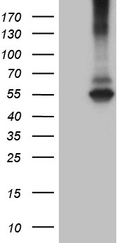 RNF149 Antibody - HEK293T cells were transfected with the pCMV6-ENTRY control. (Left lane) or pCMV6-ENTRY RNF149. (Right lane) cDNA for 48 hrs and lysed