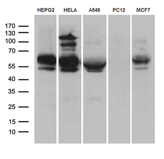 RNF149 Antibody - Western blot analysis of extracts. (35ug) from 5 cell lines by using anti-RNF149 monoclonal antibody. (1:2000)(1:500)