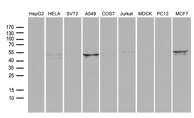 RNF149 Antibody - Western blot analysis of extracts. (35ug) from 9 different cell lines by using anti-RNF149 monoclonal antibody. (1:500)