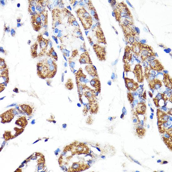 RNF149 Antibody - Immunohistochemistry of paraffin-embedded Human stomach using RNF149 Polyclonal Antibody at dilution of 1:100 (40x lens).