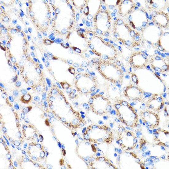 RNF149 Antibody - Immunohistochemistry of paraffin-embedded Mouse kidney using RNF149 Polyclonal Antibody at dilution of 1:100 (40x lens).