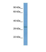 RNF150 Antibody - Western blot of Human Jurkat. RNF150 antibody dilution 1.0 ug/ml.  This image was taken for the unconjugated form of this product. Other forms have not been tested.