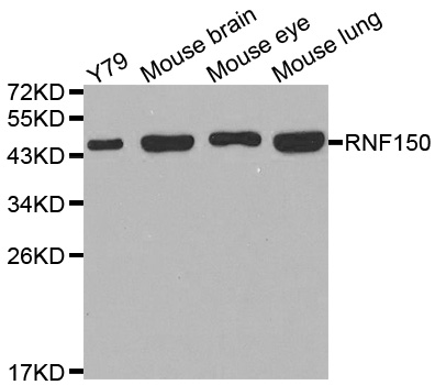 RNF150 Antibody - Western blot analysis of extracts of various cell lines, using RNF150 antibody.