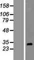 RNF151 Protein - Western validation with an anti-DDK antibody * L: Control HEK293 lysate R: Over-expression lysate