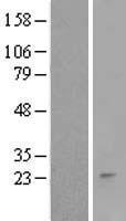 RNF152 Protein - Western validation with an anti-DDK antibody * L: Control HEK293 lysate R: Over-expression lysate