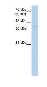 RNF165 Antibody - Western blot of Jurkat lysate using Anti-RNF165 Antibody.  This image was taken for the unconjugated form of this product. Other forms have not been tested.